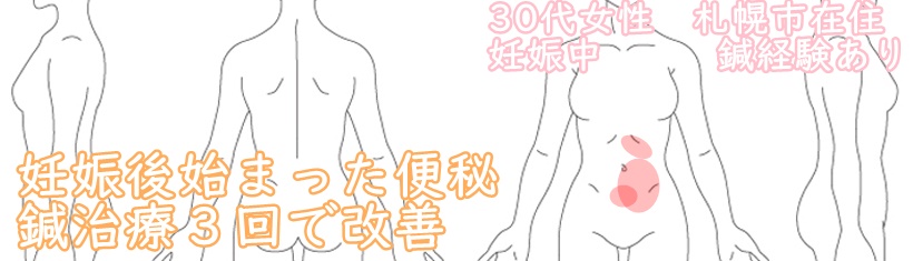 過敏性腸症候群、IBS、腹痛、ガスだまり、ガス漏れ、便秘、札幌、妊婦、白石区、鍼灸