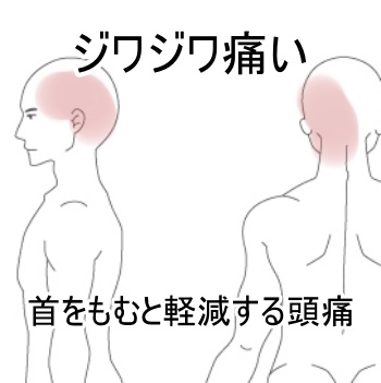 頭痛 片頭痛 緊張型頭痛 群発性頭痛 の症例 札幌市白石区のととのえ鍼灸院 鍼専門 過敏性腸症候群 Ibs 機能性ディスペプシア 腰痛はととのえ鍼灸院