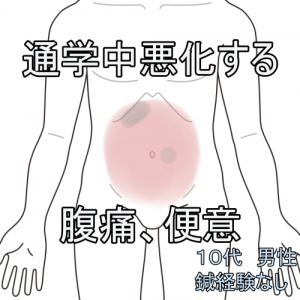 過敏性腸症候群、IBS、腹痛、ガスだまり、ガス漏れ、便秘、札幌、白石区、鍼灸