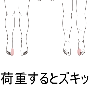 その他の症状 鍼専門 過敏性腸症候群 Ibs 機能性ディスペプシア 腰痛はととのえ鍼灸院