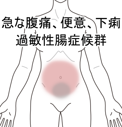 過敏性腸症候群、IBS、腹痛、下痢、札幌、白石区、鍼灸