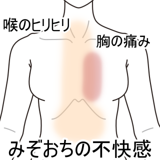 性 の 痛み 背中 炎 食道 症状 逆流 背中の痛みは病気の兆候 すい臓がん、食道がん等の可能性も(NEWSポストセブン)